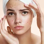 دلیل به هم ریختگی هورمون زنان