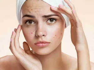 دلیل به هم ریختگی هورمون زنان