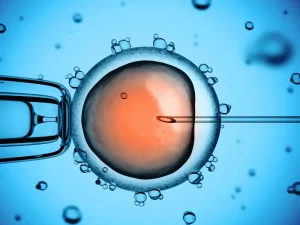 برای چه کسانی IVF انجام می شود