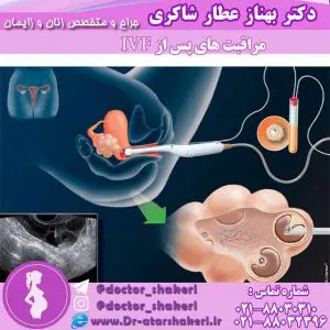 مراقبت های پی از درمان ناباروری با IVF
