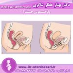 واژینیسموس چیست ؟