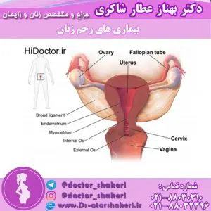 بیماری های رحم زنان