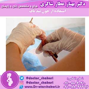 استفاده از خون بند ناف