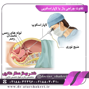 تفاوت جراحی باز با لاپاراسکوپی