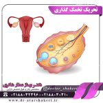 تحریک تخمک گذاری