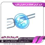 فریز کردن تخمک در دختران باکره
