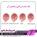 عکس-جفت-سرراهی