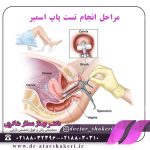 مراحل انجام تست پاپ اسمیر