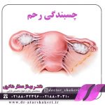 چسبندگی رحم