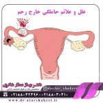 علل و علائم حاملگی خارج از رحم