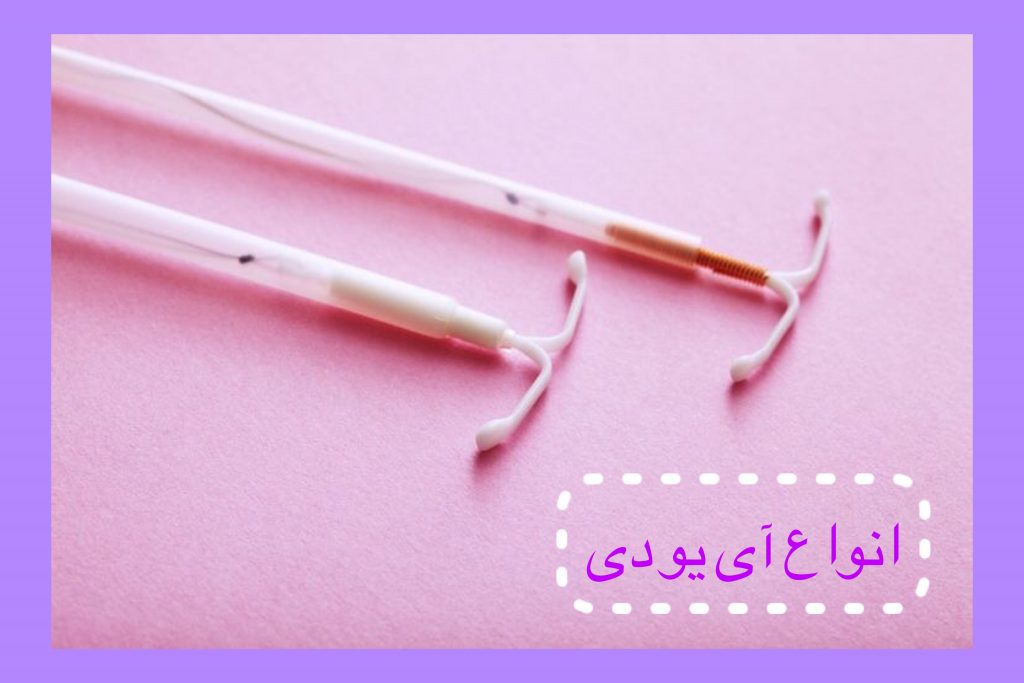 انواع آی یو دی