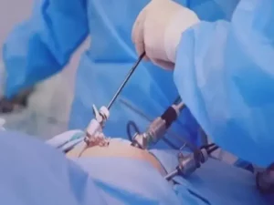 عوارض لاپاراتومی