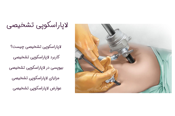لاپاراسکوپی تشخیصی