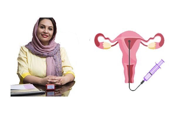 بهترین دکتر آی یو آی در تهران