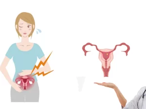 درباره لاپاراسکوپی فیبروم