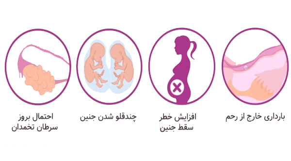 عوارض آی وی اف