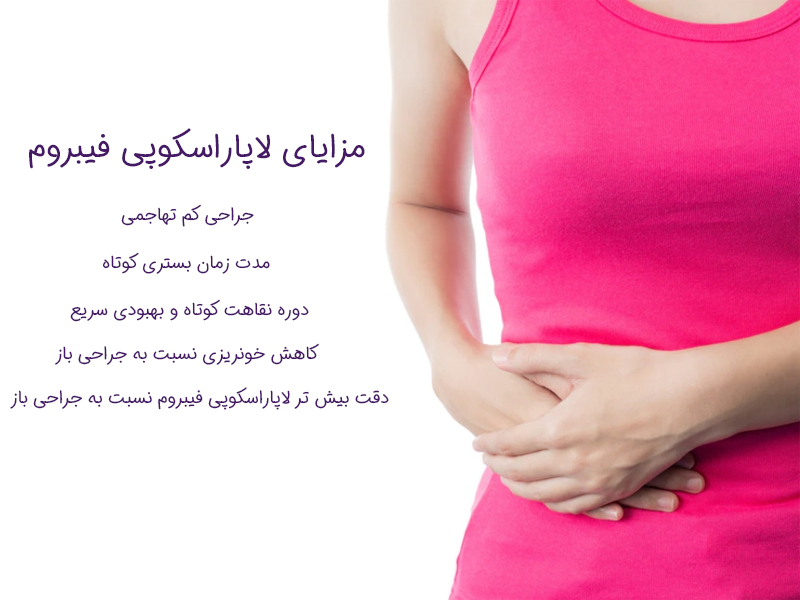 مزایای لاپاراسکوپی فیبروم