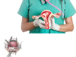 مراقبت های بعد از هیسترکتومی - دکتر بهناز عطارشاکری