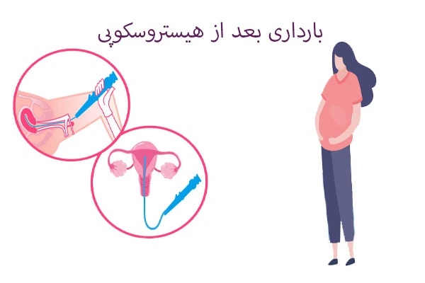 بارداری بعد از هیستروسکوپی