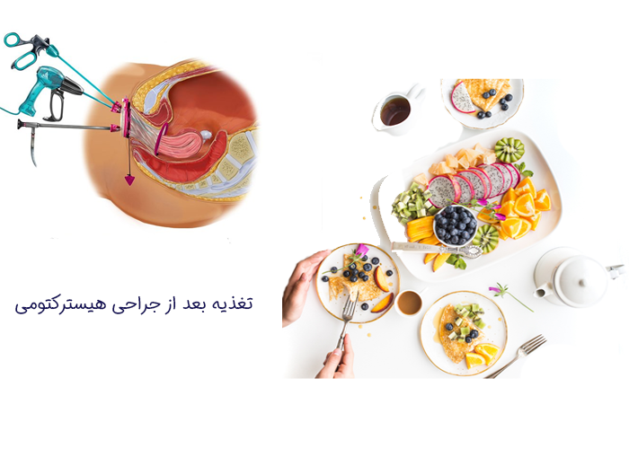 بهترین رژیم غذایی بعد از هیسترکتومی