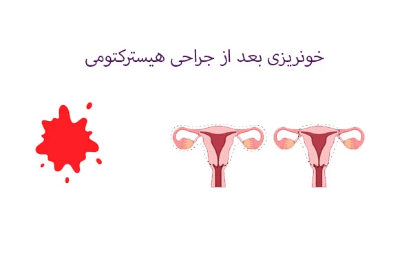 علت خونریزی بعد هیسترکتومی