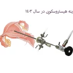 هزینه هیستروسکوپی در سال 1403