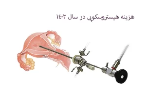 هزینه هیستروسکوپی در سال 1403