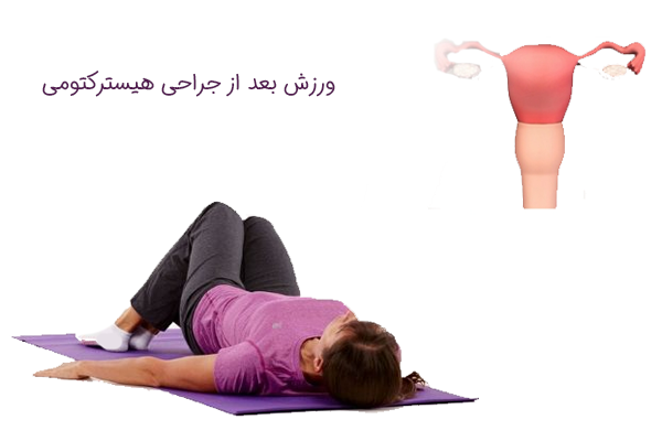 ورزش بعد از جراحی هیسترکتومی