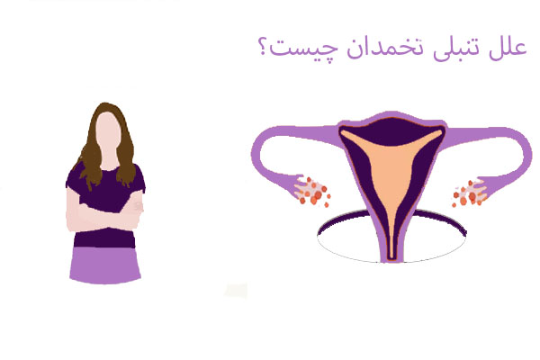 علل تنبلی تخمدان علل تنبلی تخمدان