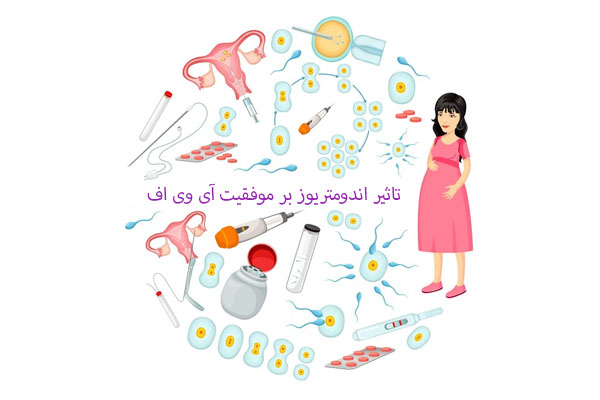 تاثیر اندومتریوز بر موفقیت آی وی اف