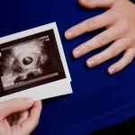 ساک حاملگی یا کیسه جنینی - دکتر بهناز عطارشاکری