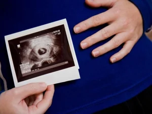 ساک حاملگی یا کیسه جنینی - دکتر بهناز عطارشاکری