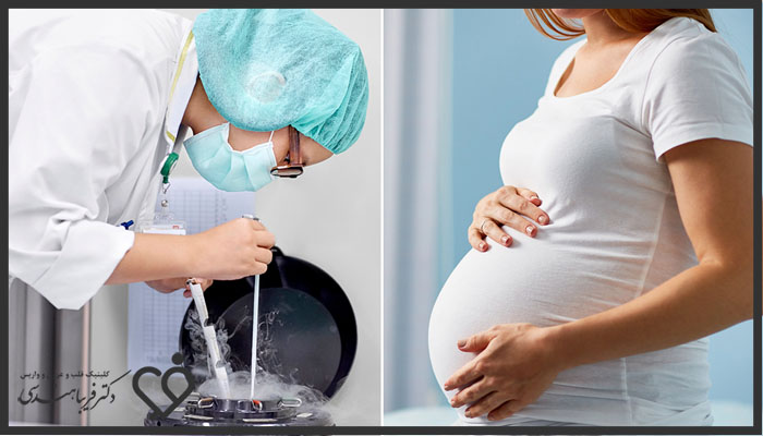 مراحل فریز کردن تخمک در زنان جوان