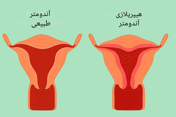 سرطان-های-مربوط-به-دستگاه-تناسلی